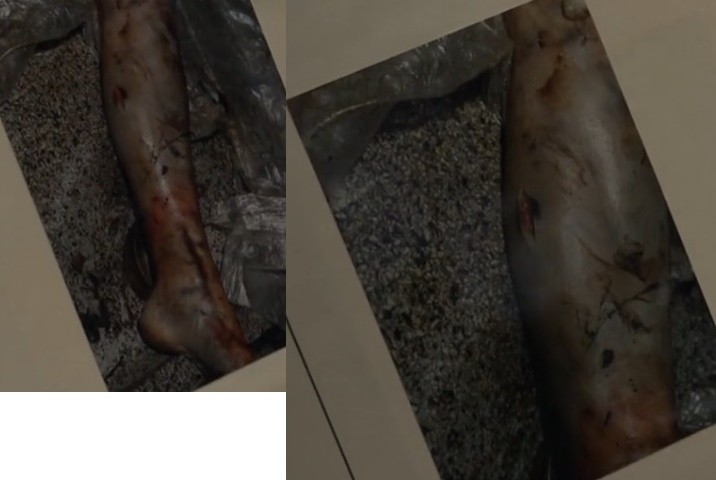hrabankova-detail---poranena-noha.jpg